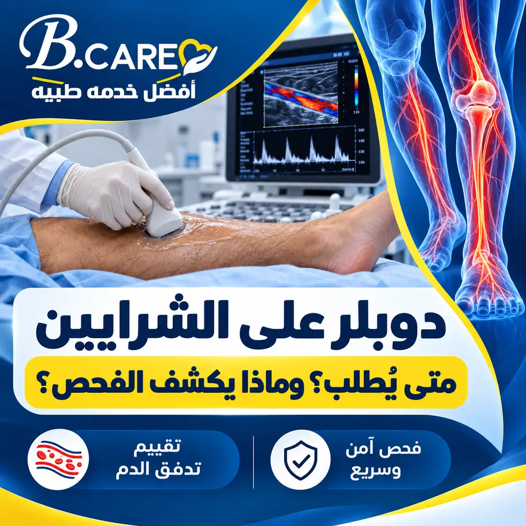 دوبلر على الشرايين
