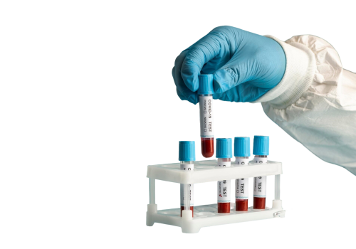 hand-with-protective-gloves-holding-blood-samples-covid-test