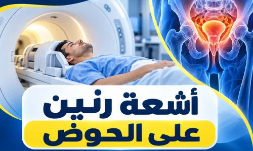 أشعة رنين على الحوض
