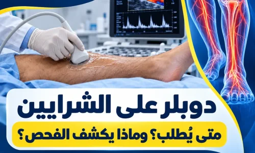 دوبلر على الشرايين